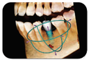 VATECH EZ 3d-i