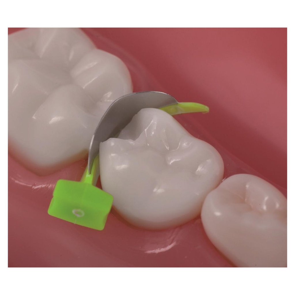 FENDERMATE PRIME ASSORTIMENT 2X18 PCS     DIRECTA