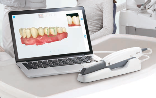 [benq BIS 1] BenQ Intraoral Scanner BIS-1